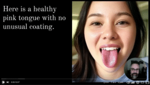 Tongue Diagnosis (no intro)